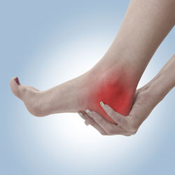 San Francisco Plantar Fasciitis Dolor Quiropráctico